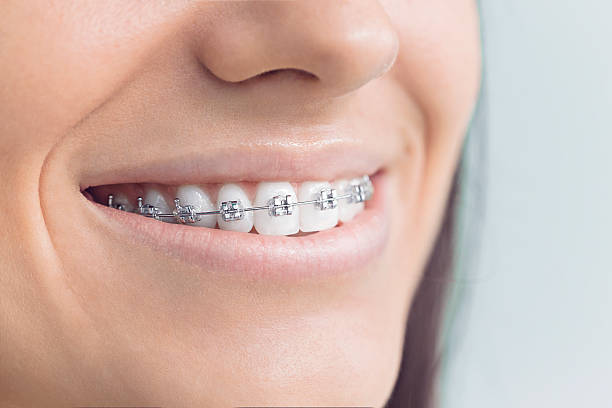 Best Full Mouth Reconstruction  in Port Allen, LA